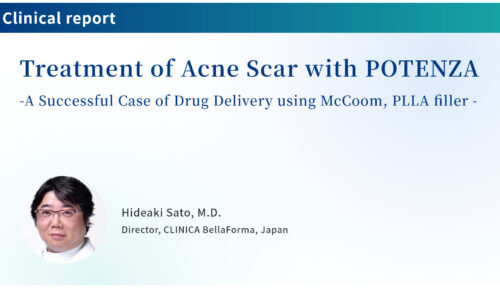Treatment of Acne Scar with POTENZA – A Successful Case of Drug Delivery using McCoom, PLLA filler –